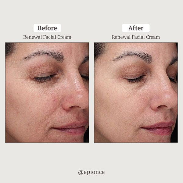 Renewal Facial Cream